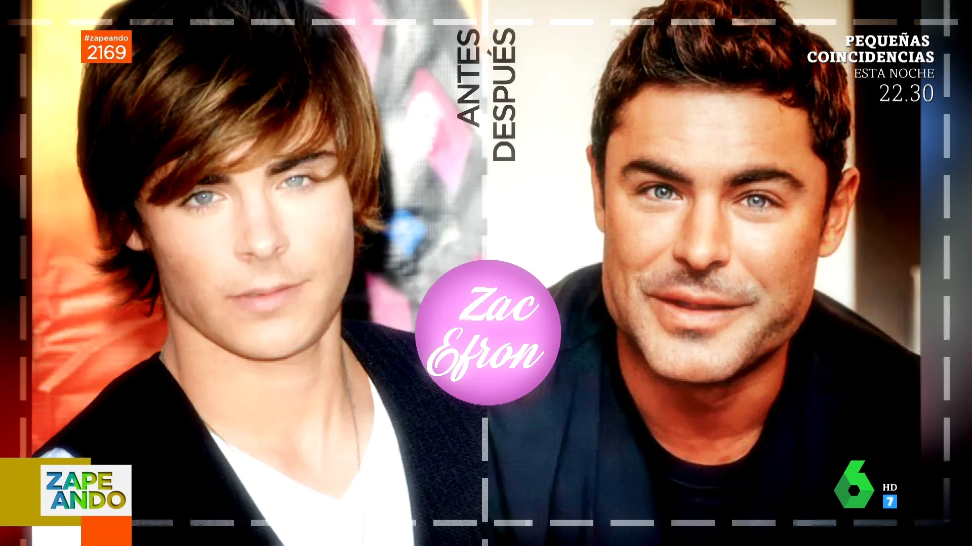 ¿Qué retoques estéticos tienen Zendaya, Zac Efron o Adele? Este cirujano plástico analiza el antes y después de los famosos