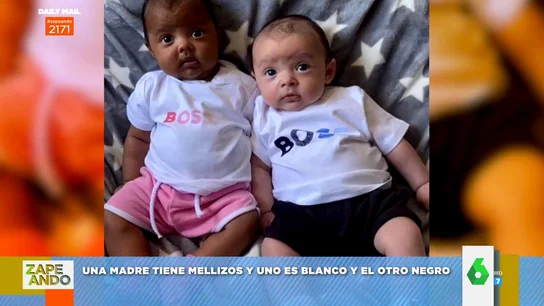 Una madre tiene dos mellizos de diferente color: esta es la explicación científica de por qué uno es blanco y otro negro Una madre tiene dos mellizos de diferente color: esta es la explicación científica de por qué uno es blanco y otro negro
