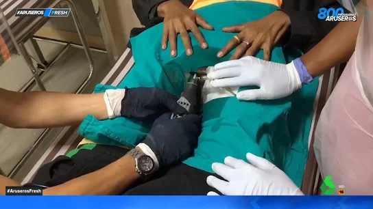 La escalofriante operación para retirar un anillo contra la eyaculación precoz atascado en un pene La escalofriante operación para retirar un anillo contra la eyaculación precoz atascado en un pene