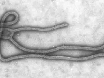 Virus del ébola Virus del ébola