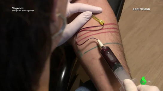 Sangre humana para hacer morcillas: la receta 'vegana' de un hombre de Teruel Sangre humana para hacer morcillas: la receta 'vegana' de un hombre de Teruel