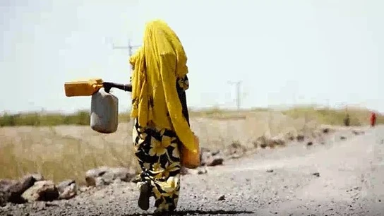 Desnutrición infantil en el Cuerno de África. Desnutrición infantil en el Cuerno de África.