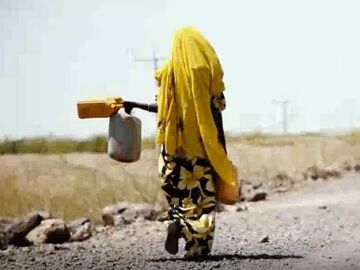 Desnutrición infantil en el Cuerno de África.