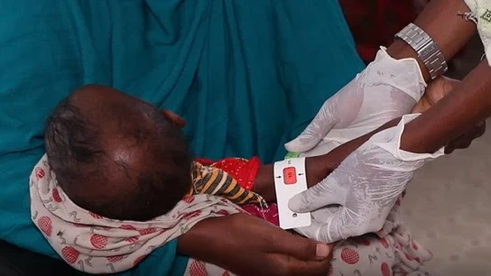 Examen de desnutrición en el Cuerno de África Examen de desnutrición en el Cuerno de África
