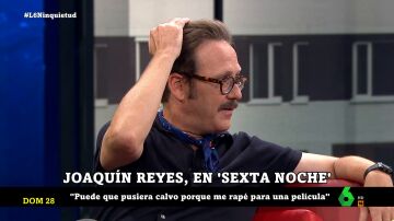 "No me he puesto pelo, se me ve la coronilla": Joaquín Reyes responde a lo que los espectadores buscan sobre él en Internet