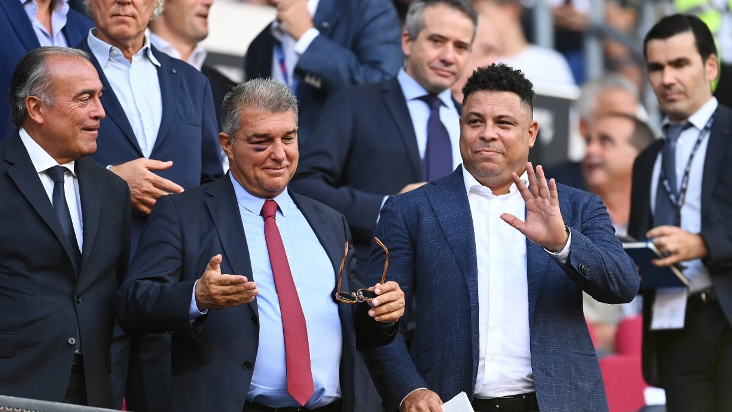 Joan Laporta, con un ojo morado en el Barça-Valladolid Joan Laporta, con un ojo morado en el Barça-Valladolid