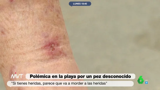 pez mordedor pez mordedor