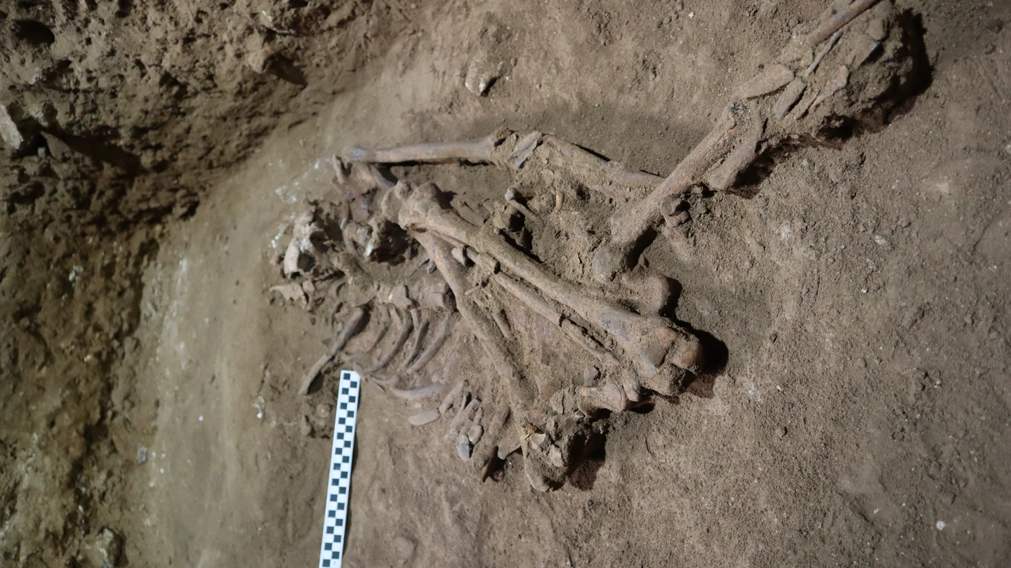 La primera amputación quirúrgica se habría realizado hace 31.000 años La primera amputación quirúrgica se habría realizado hace 31.000 años