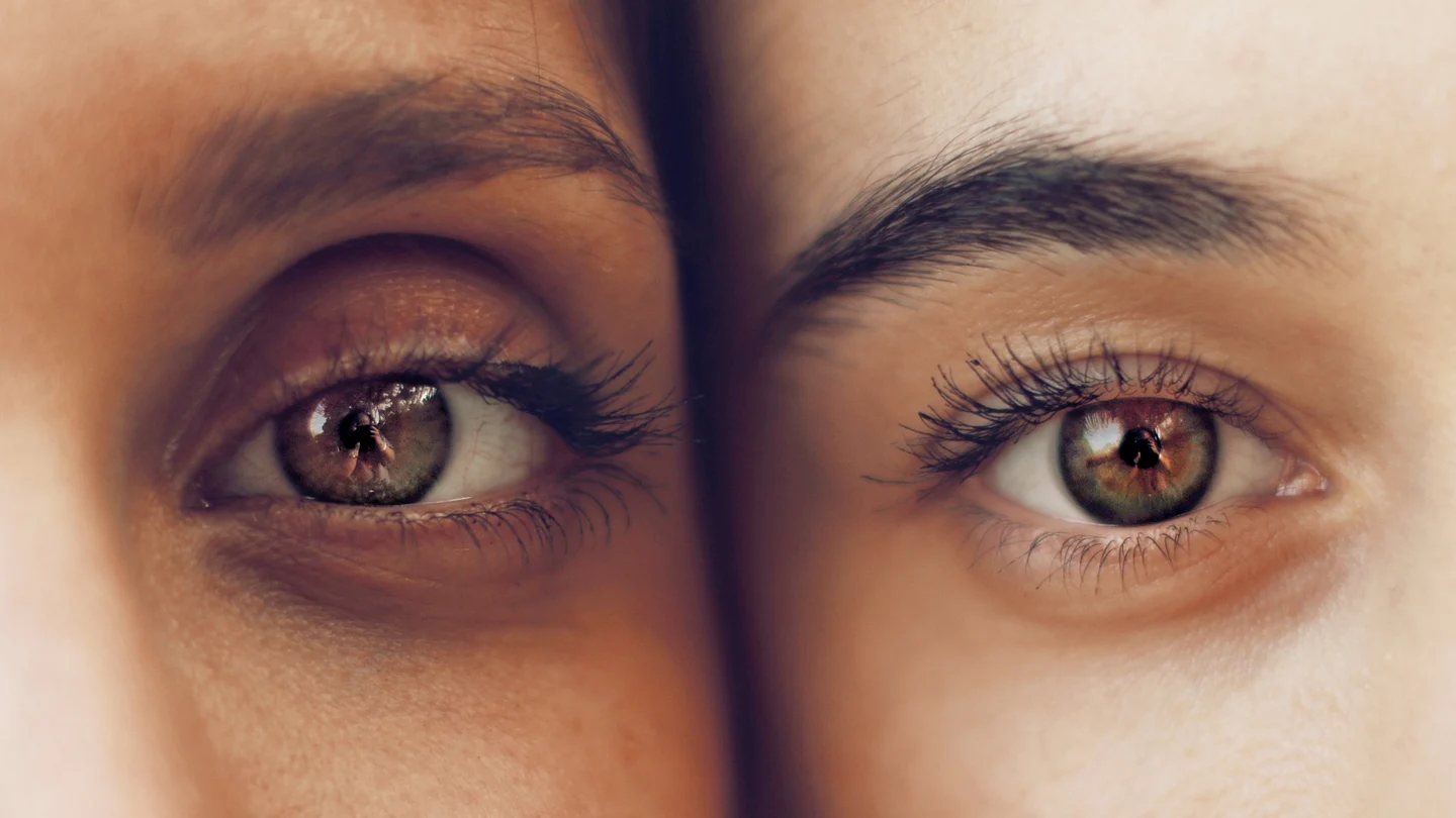 Cómo quitar las ojeras y las bolsas de los ojos Cómo quitar las ojeras y las bolsas de los ojos