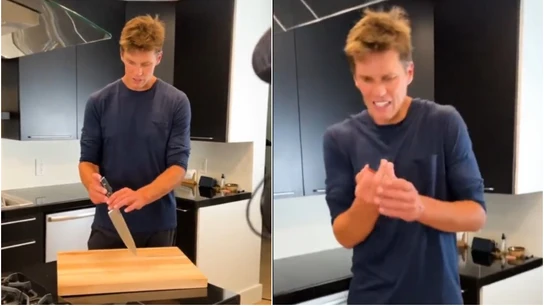Tom Brady, con un dedo amputado Tom Brady, con un dedo amputado