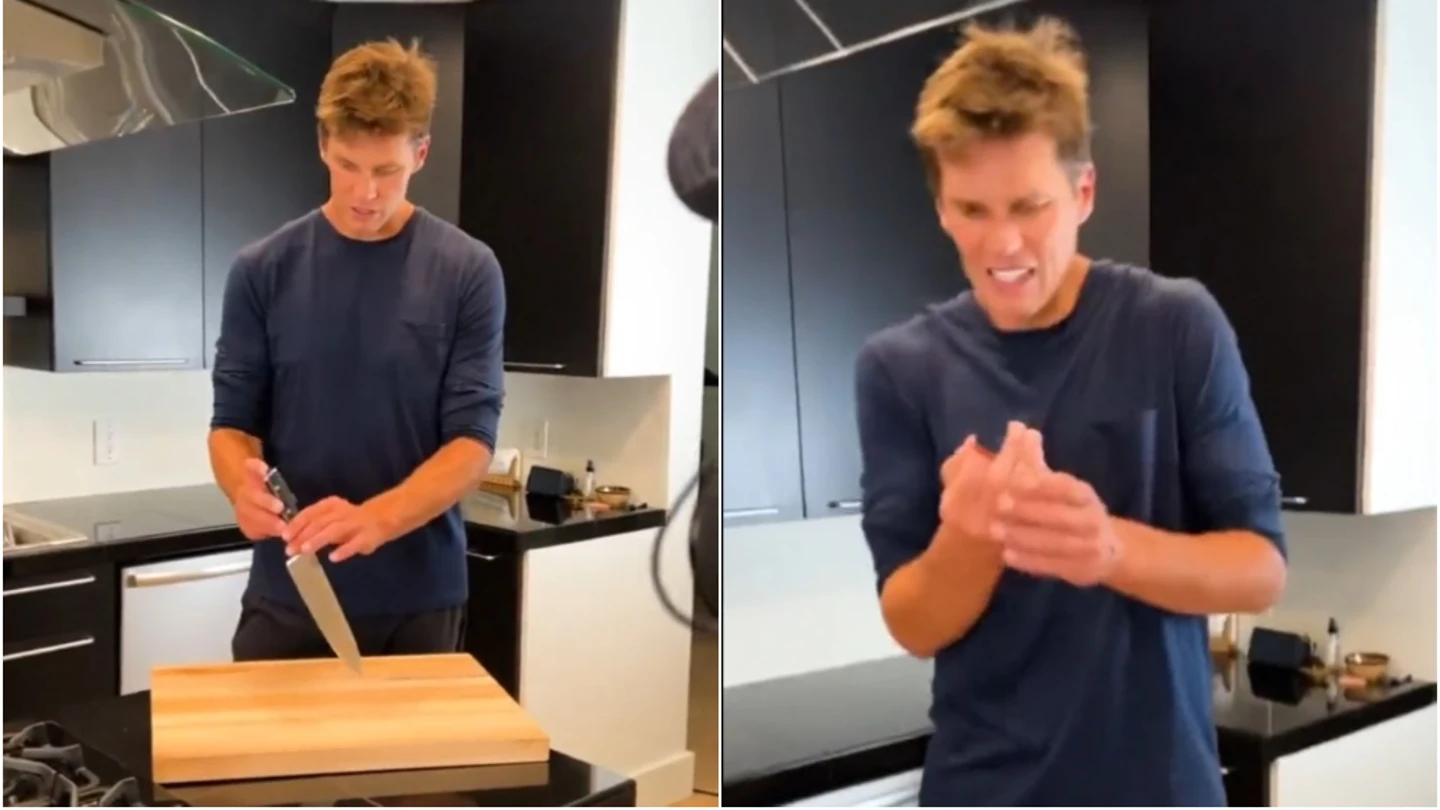 Tom Brady, con un dedo amputado Tom Brady, con un dedo amputado