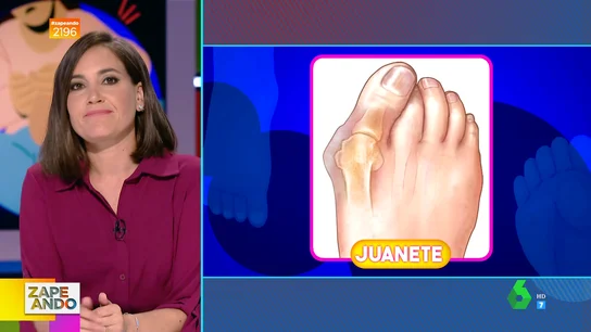 Las claves de los juanetes: Boticaria García explica por qué salen y los trucos caseros para evitarlos Las claves de los juanetes: Boticaria García explica por qué salen y los trucos caseros para evitarlos