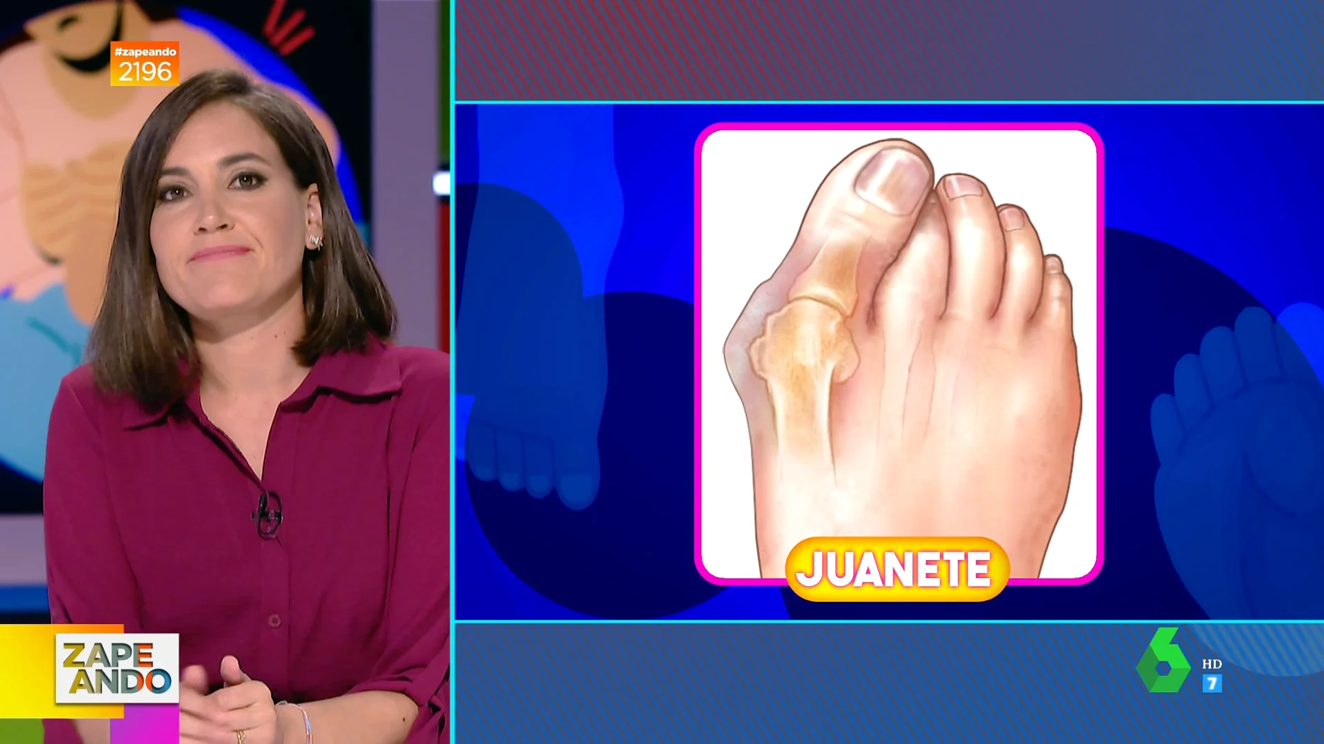 Las claves de los juanetes: Boticaria García explica por qué salen y los trucos caseros para evitarlos