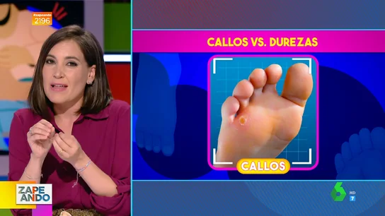 ¿En qué se diferencian un callo y una dureza? ¿En qué se diferencian un callo y una dureza?