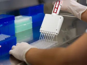 El inicio simultaneo del tratamiento antirretroviral y la inmunoterapia mejora el control del VIH El inicio simultaneo del tratamiento antirretroviral y la inmunoterapia mejora el control del VIH
