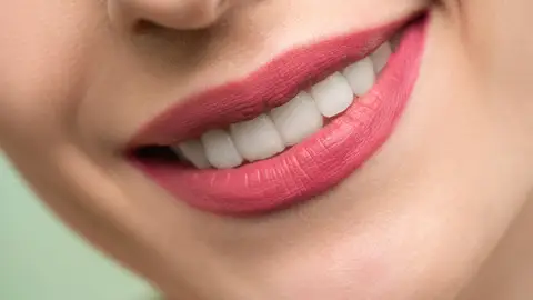 Sonrisa con dientes blancos Sonrisa con dientes blancos