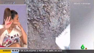 "Hay más piojos que pelos": el vídeo viral de una joven que tiene la cabeza plagada de liendres