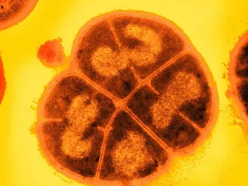 Bacteria D. radiodurans Bacteria D. radiodurans