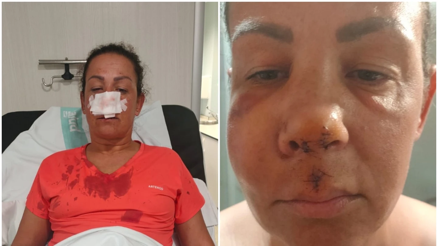 María del Mar, tras ser agredida por un joven mientras paseaba a su perro María del Mar, tras ser agredida por un joven mientras paseaba a su perro