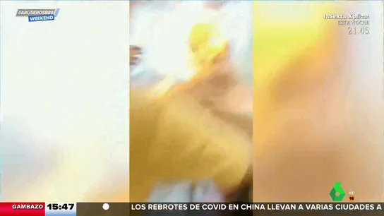 Cuando cortarse el pelo al fuego sale mal y te quemas hasta el pecho Cuando cortarse el pelo al fuego sale mal y te quemas hasta el pecho