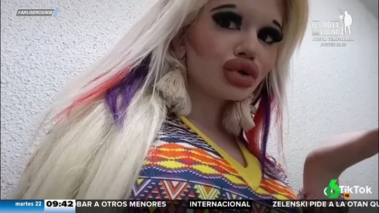 La 'Barbie humana' quiere volver a aumentarse los pechos a pesar de la advertencia de sus médicos La 'Barbie humana' quiere volver a aumentarse los pechos a pesar de la advertencia de sus médicos