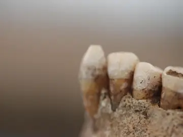 Perfil de una mandíbula de una muestra del Neolítico del sur de Italia Perfil de una mandíbula de una muestra del Neolítico del sur de Italia