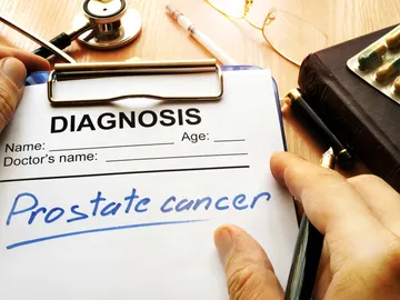 Cáncer de próstata Cáncer de próstata