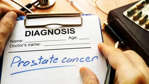Cáncer de próstata Cáncer de próstata