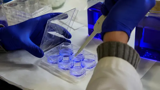 Hallazgo clave: científicos identifican una terapia contra un subtipo de melanoma sin tratamiento Hallazgo clave: científicos identifican una terapia contra un subtipo de melanoma sin tratamiento