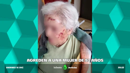 Agreden a una mujer de 93 años en una residencia madrileña Agreden a una mujer de 93 años en una residencia madrileña