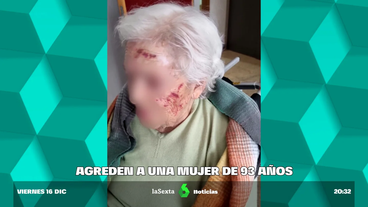 Agreden a una mujer de 93 años en una residencia madrileña Agreden a una mujer de 93 años en una residencia madrileña
