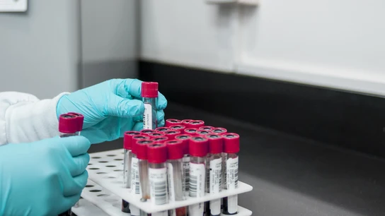 Imagen de archivo de un científico manipulando tubos de muestras en un laboratorio Imagen de archivo de un científico manipulando tubos de muestras en un laboratorio