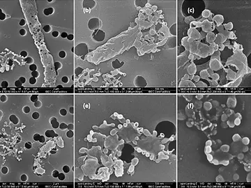 Descomposición de la membrana en una estructura similar a una vesícula en la bacteria Pseudomonas aeruginosa tratada con el antibiótico ciprofloxacina Descomposición de la membrana en una estructura similar a una vesícula en la bacteria Pseudomonas aeruginosa tratada con el antibiótico ciprofloxacina