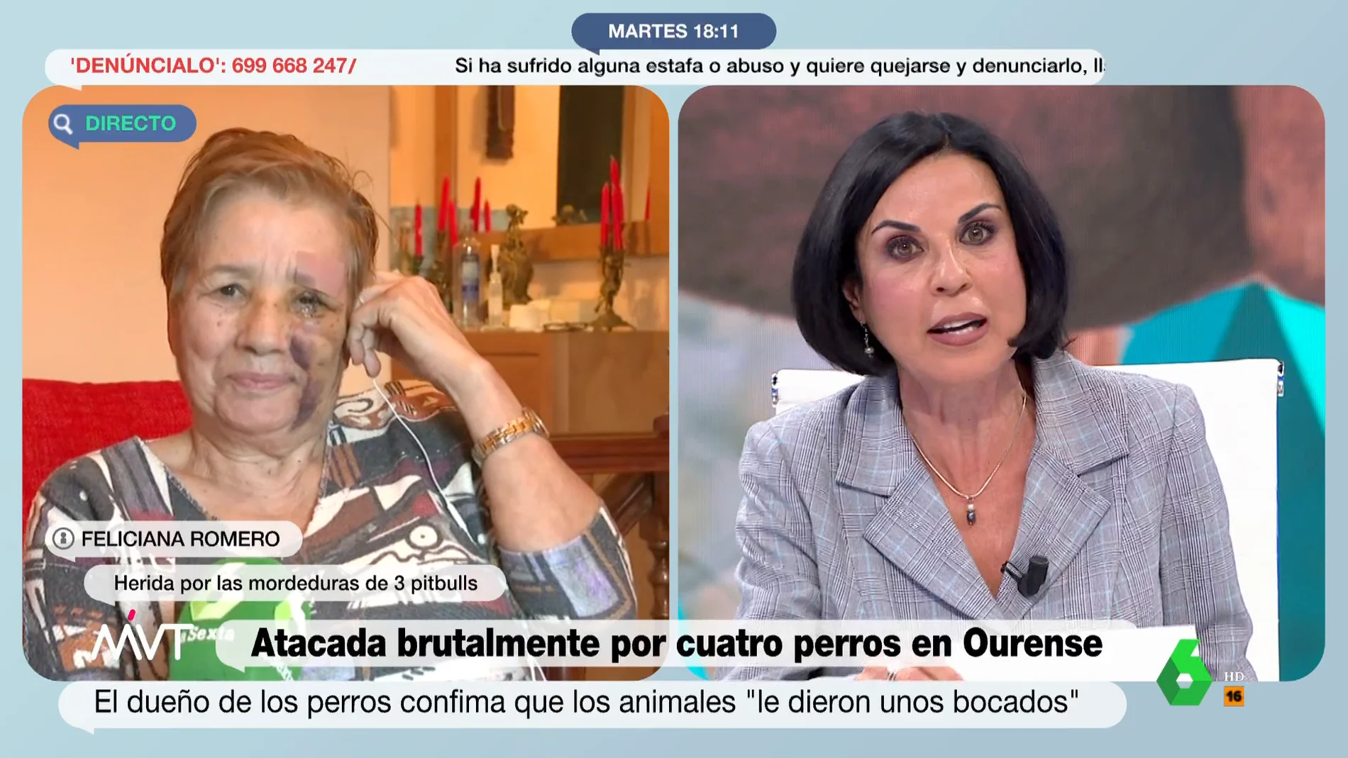 La indignación de Beatriz de Vicente con el dueño de los perros que atacaron a una mujer en Ourense: "Estoy escandalizada"
