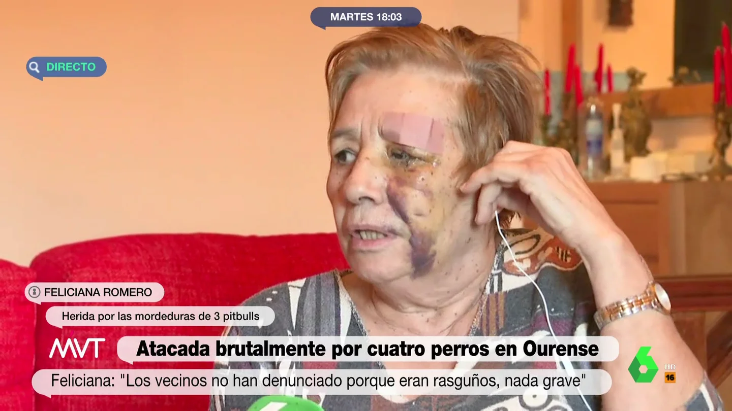 El aterrador relato de Feliciana, la mujer atacada por cuatro perros: "Yo echaba sangre por todos los sitios; estaba comida" El aterrador relato de Feliciana, la mujer atacada por cuatro perros: "Yo echaba sangre por todos los sitios; estaba comida"
