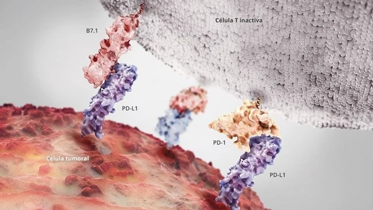Cómo detectar el cáncer de vejiga, el quinto tumor más frecuente en España. Inmunoterapia para tratar el tumor. Cómo detectar el cáncer de vejiga, el quinto tumor más frecuente en España. Inmunoterapia para tratar el tumor.