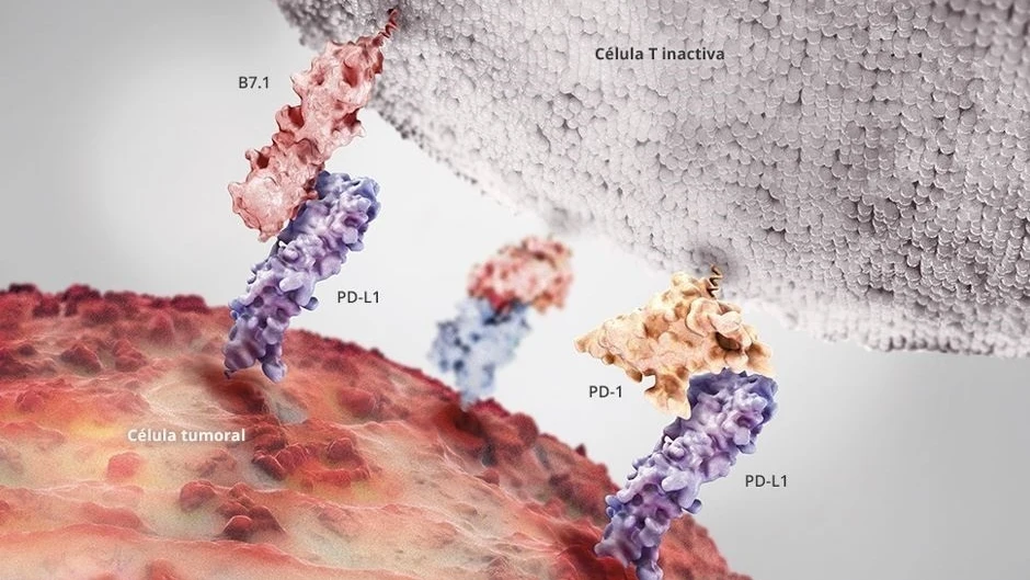Cómo detectar el cáncer de vejiga, el quinto tumor más frecuente en España. Inmunoterapia para tratar el tumor. 