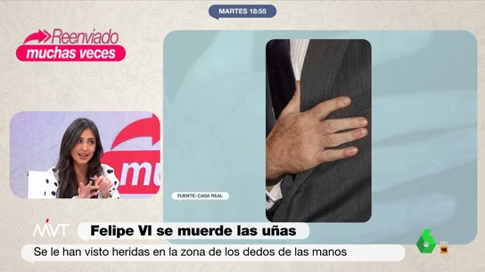 El hábito compulsivo de Felipe VI que le hace tener heridas en las manos El hábito compulsivo de Felipe VI que le hace tener heridas en las manos