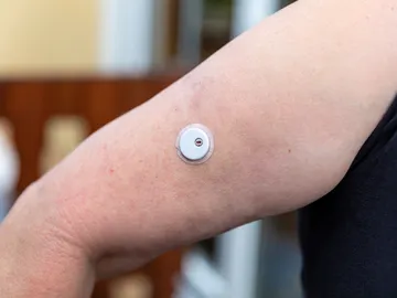 Sensor en el brazo para medir la glucosa Sensor en el brazo para medir la glucosa