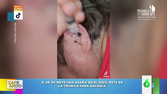 El desagradable vídeo viral que explica el truco de cómo sacar una araña del oído El desagradable vídeo viral que explica el truco de cómo sacar una araña del oído