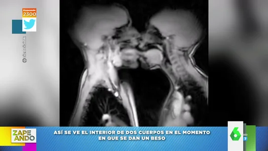 Así reaccionan los cuerpos de un hombre y una mujer por dentro cuando se dan un beso Así reaccionan los cuerpos de un hombre y una mujer por dentro cuando se dan un beso