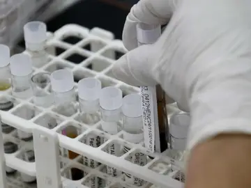 Análisis de sangre Análisis de sangre