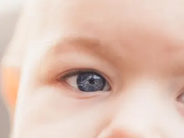 retina para detectar síndorme de Dravet retina para detectar síndorme de Dravet