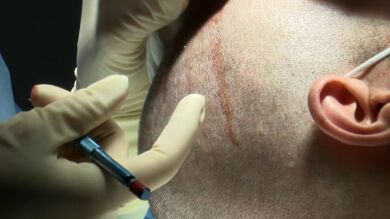 Equipo de Investigaci&oacute;n Fiebre del pelo