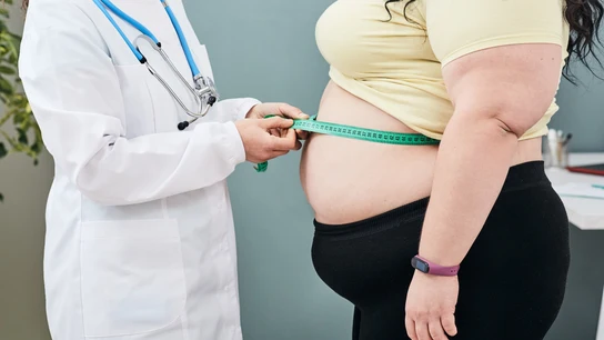 Una persona con obesidad. Una persona con obesidad.