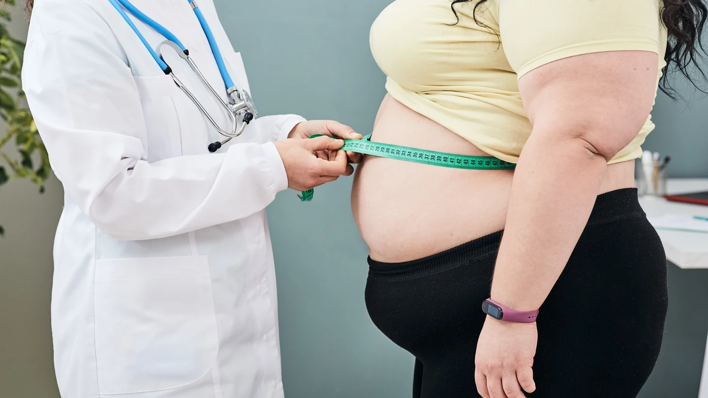 Una persona con obesidad. Una persona con obesidad.