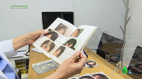 El "efecto José Bono", el boom de los trasplantes capilares en España El "efecto José Bono", el boom de los trasplantes capilares en España