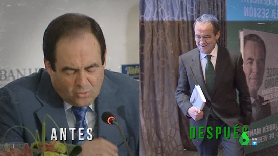 José Bono desvela qué le llevó a trasplantarse pelo José Bono desvela qué le llevó a trasplantarse pelo