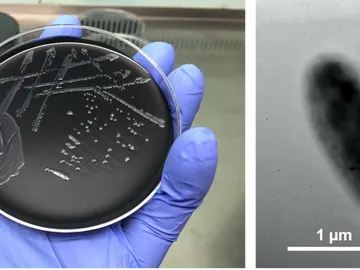 Legionella maioricenseis Legionella maioricenseis