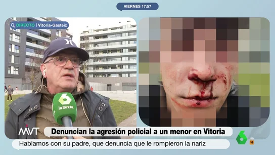 Carlos, padre del menor presuntamente apalizado por la policía en Vitoria. Padre